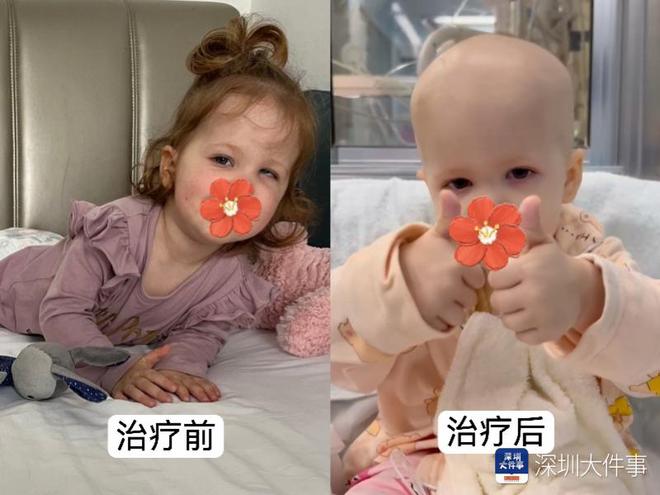 基因治療“逆天改命”！瑞典罕見遺傳病患兒萬里赴粵重獲新生(圖2)